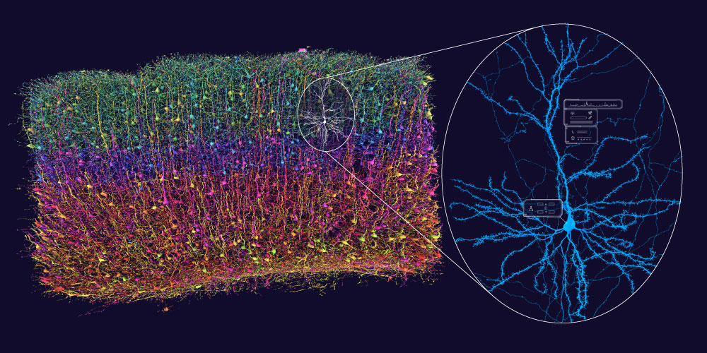 Colored 3D renderings of neurons showing a central yellow trunk with green and blue branches and small orange synaptic boutons on a black background. No visible text. Tone is scientific and detailed.